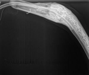 TRUS x-ray fishhook